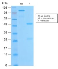 Data from SDS-PAGE analysis of Anti-bcl-2 antibody (Clone BCL2/2210R). Reducing lane (R) shows heavy and light chain fragments. NR lane shows intact antibody with expected MW of approximately 150 kDa. The data are consistent with a high purity, intact mAb.